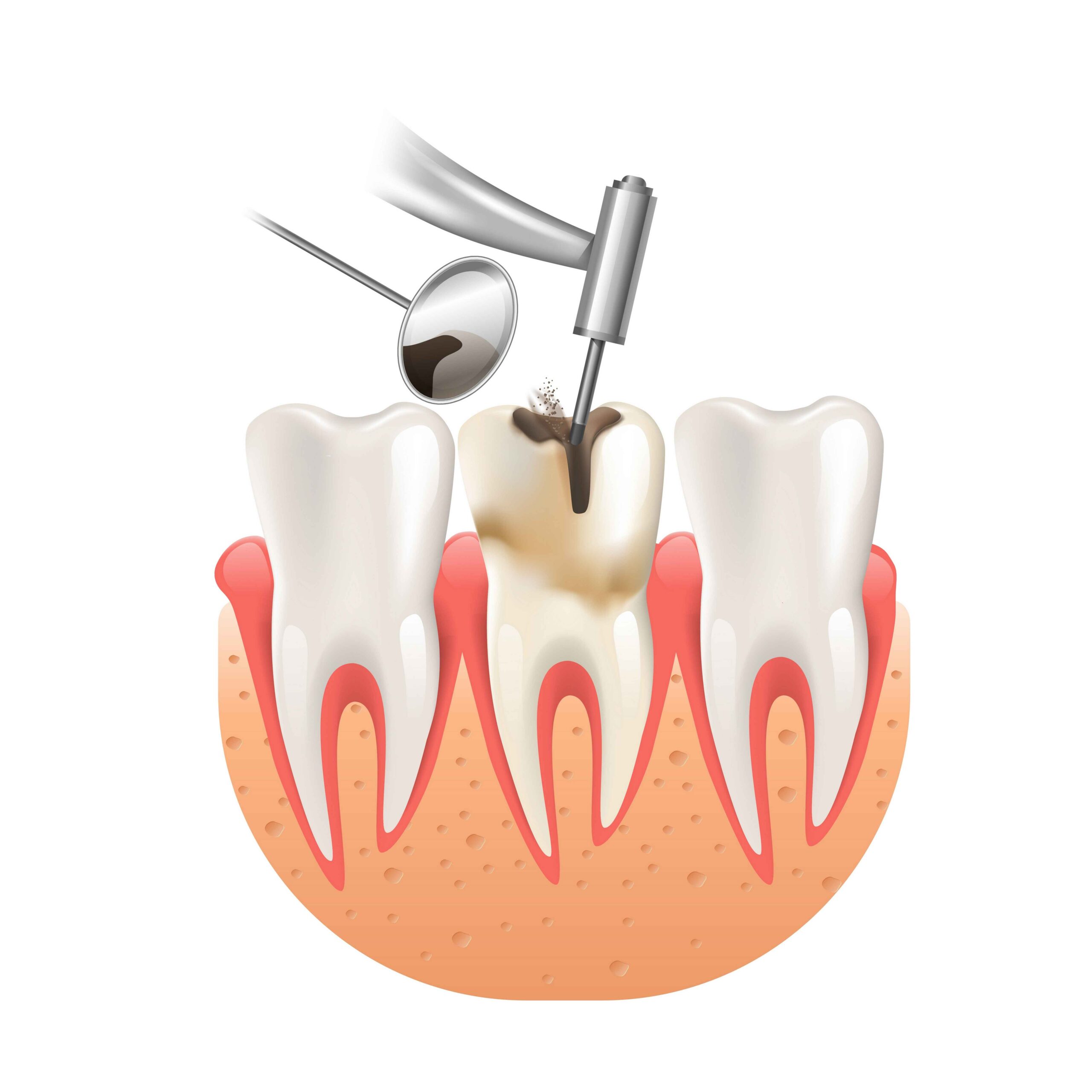 Single Visit RCT
