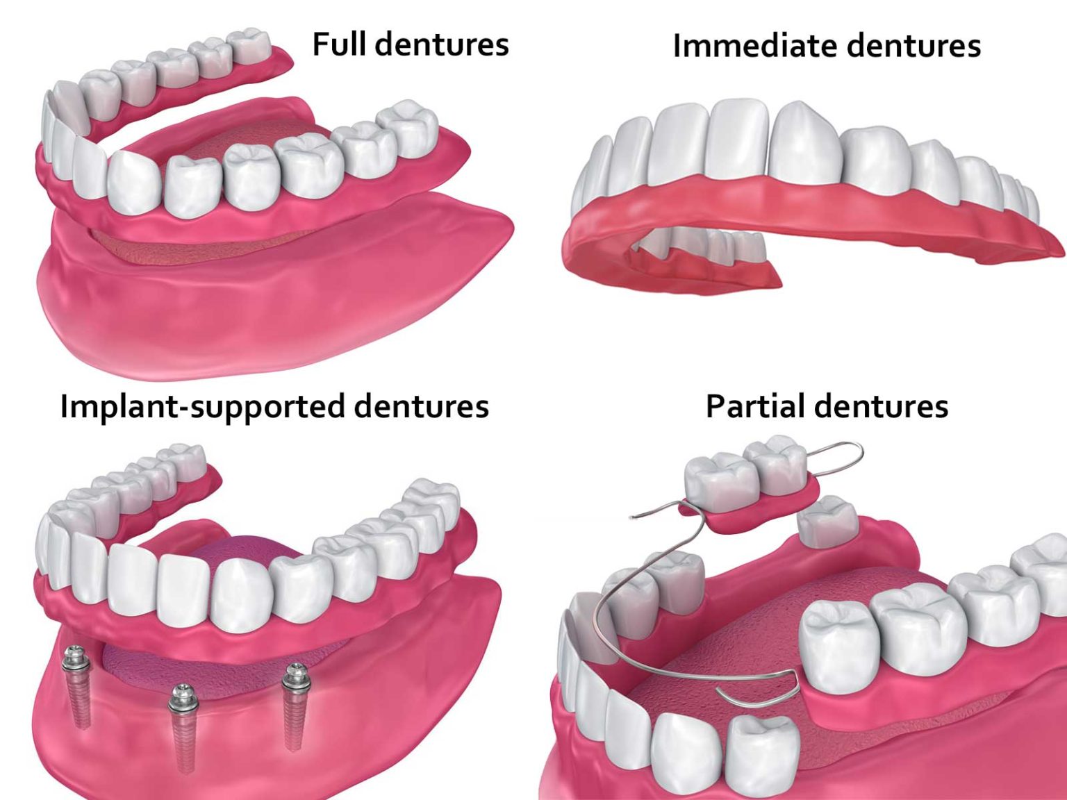 different-types-of-dentures