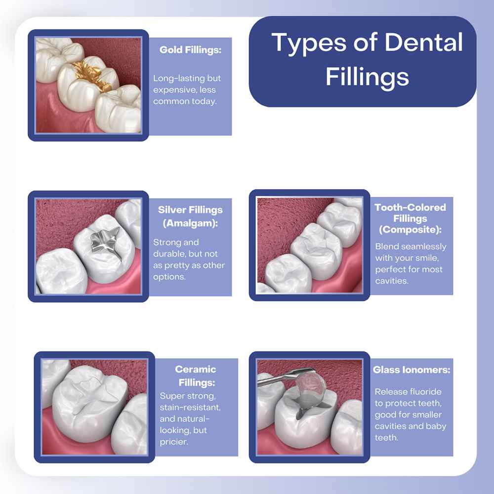 types-of-dental-fillings