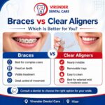 Braces vs Clear Aligners