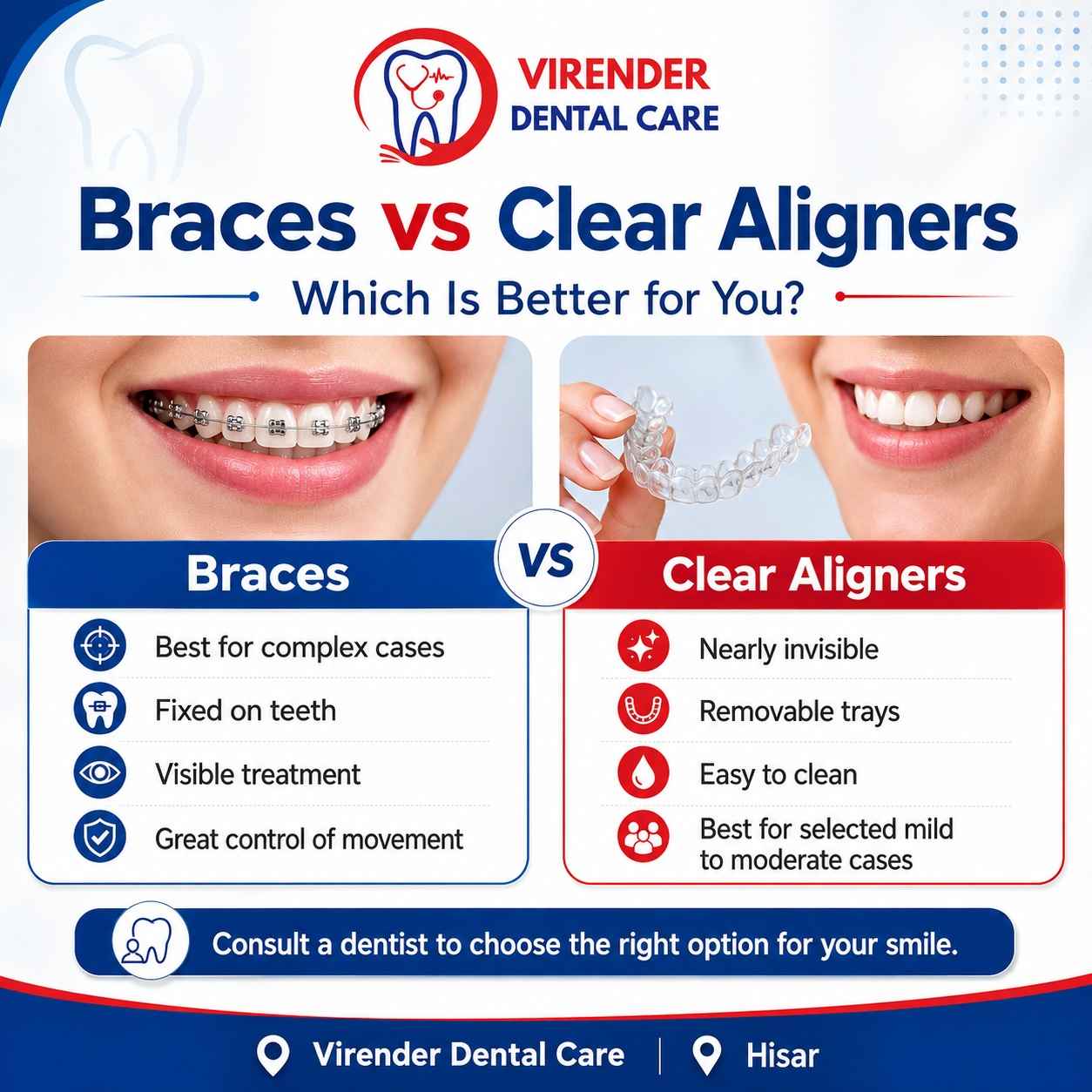 Braces vs Clear Aligners