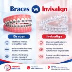 Braces vs Aligners Which Is Better for Straight Teeth
